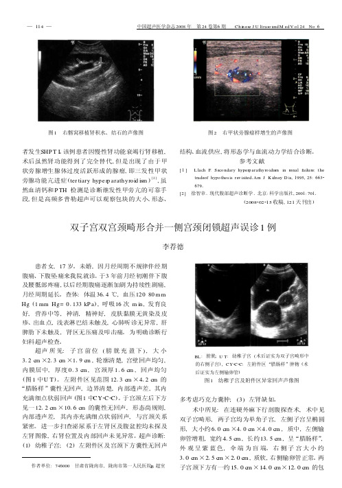 双子宫双宫颈畸形合并一侧宫颈闭锁超声误诊1例