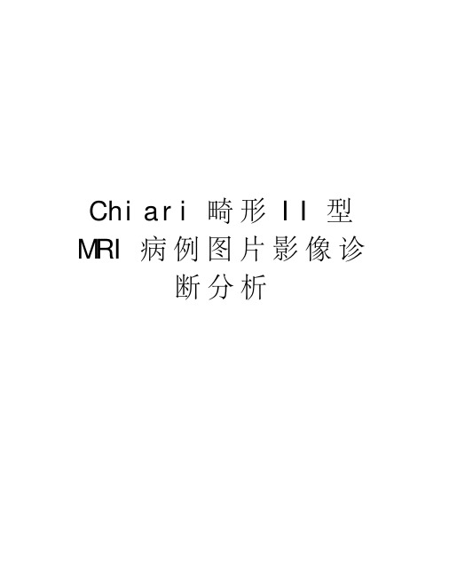 chiari畸形ii型mri病例图片影像诊断分析演示教学
