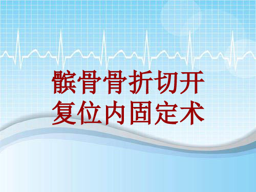 外科手术教学资料：髌骨骨折切开复位内固定术讲解模板