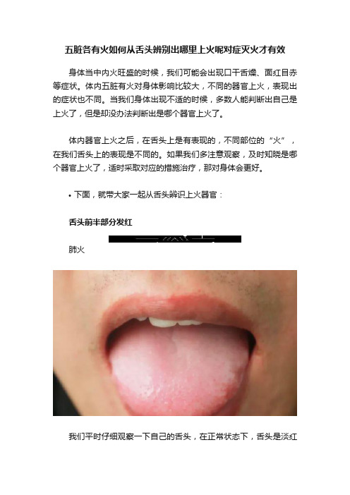 五脏各有火如何从舌头辨别出哪里上火呢对症灭火才有效