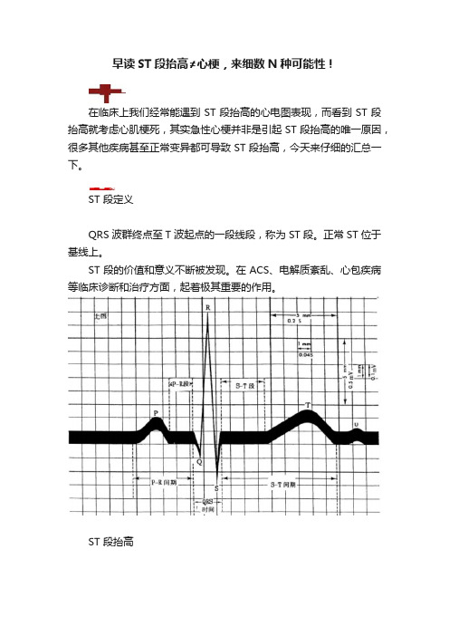 早读ST段抬高≠心梗，来细数N种可能性！