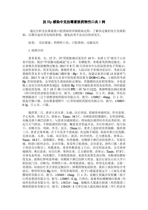 抗Hp感染中克拉霉素致药物性口炎1例