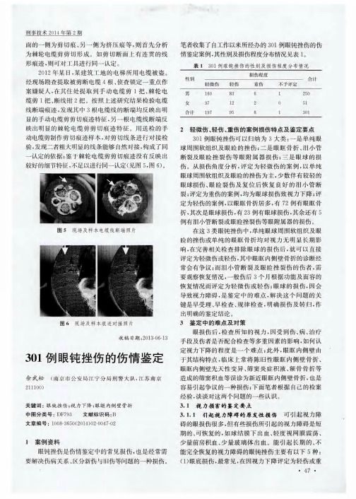 301例眼钝挫伤的伤情鉴定