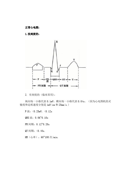 正常心电图