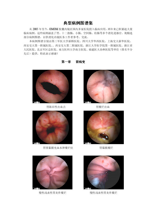 胶囊内镜临床疾病图谱