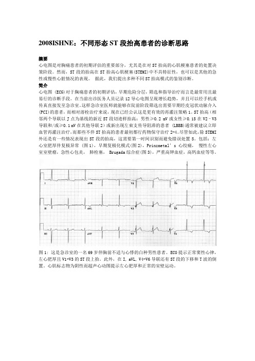 不同形态ST段抬高患者的诊断思路