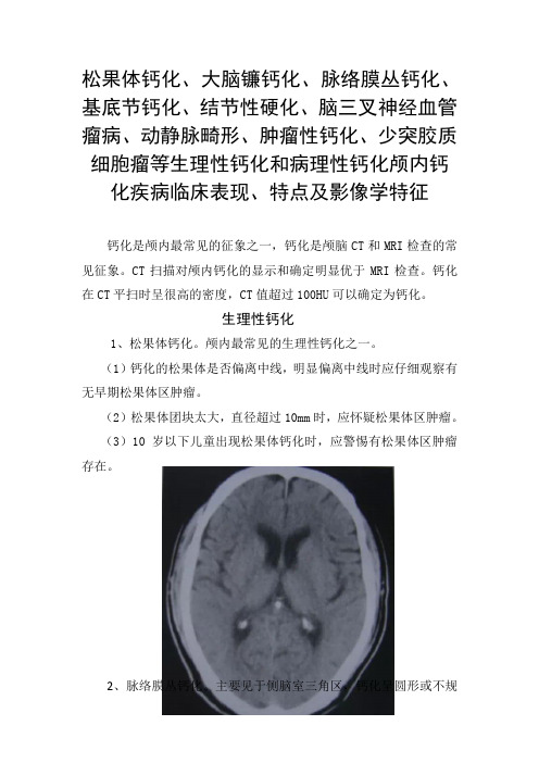 松果体钙化、动静脉畸形、少突胶质细胞瘤等生理性钙化和病理性钙化颅内钙化疾病临床表现、特点及影像学特征