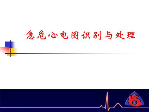 急危心电图识别与处理精选全文