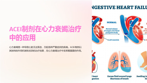 ACEI制剂在心力衰竭治疗中的应用