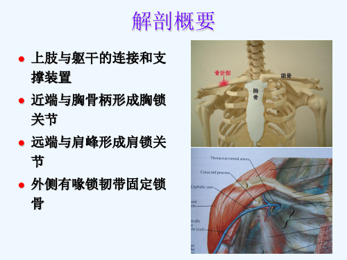 股骨颈空心螺钉髓内固定治疗成人锁骨骨折PPT