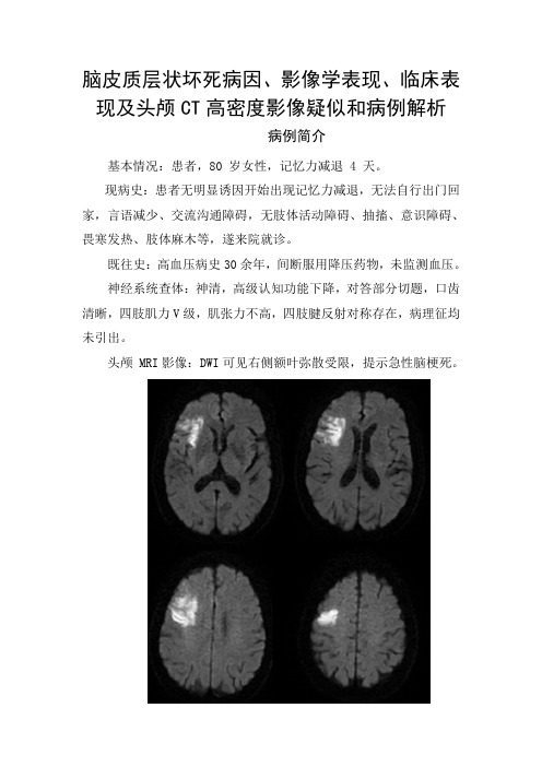 脑皮质层状坏死病因、影像学表现、临床表现及头颅CT高密度影像疑似表现和病例解析