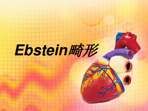 Ebstein畸形三尖瓣下移畸形