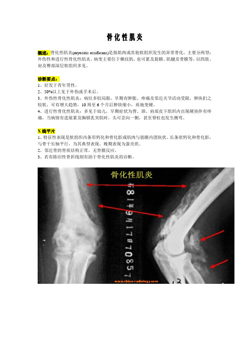 骨化性肌炎