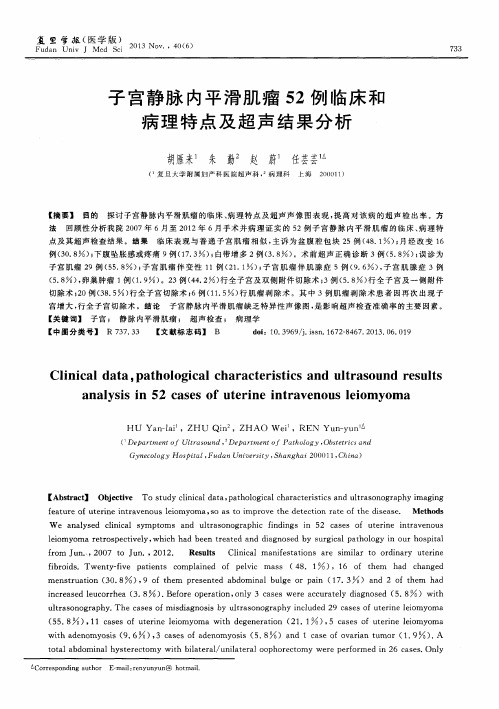 子宫静脉内平滑肌瘤52例临床和病理特点及超声结果分析