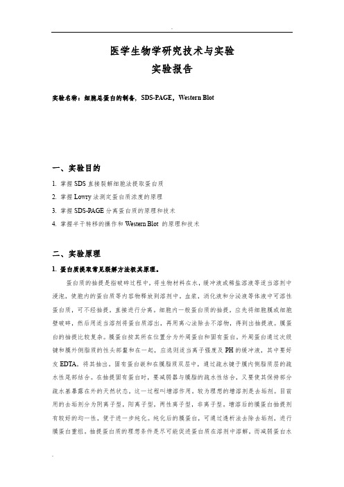 细胞总蛋白的制备, SDS-PAGE,Western Blot