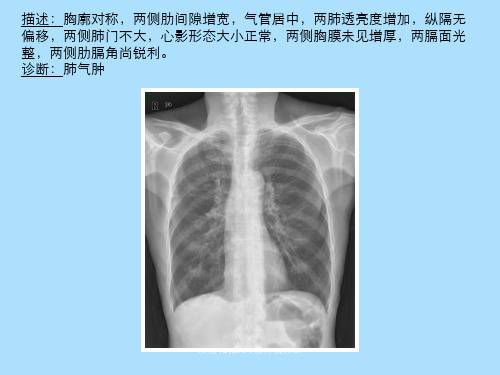 常见40张X片读片及诊断 