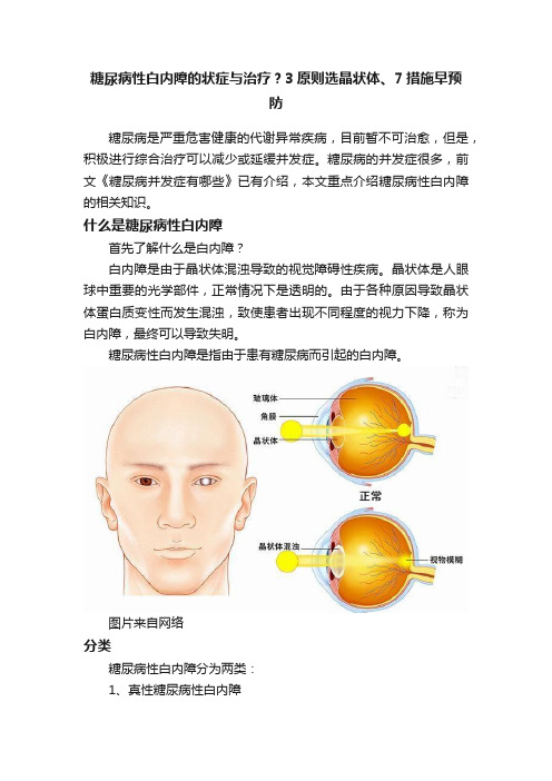 糖尿病性白内障的状症与治疗？3原则选晶状体、7措施早预防