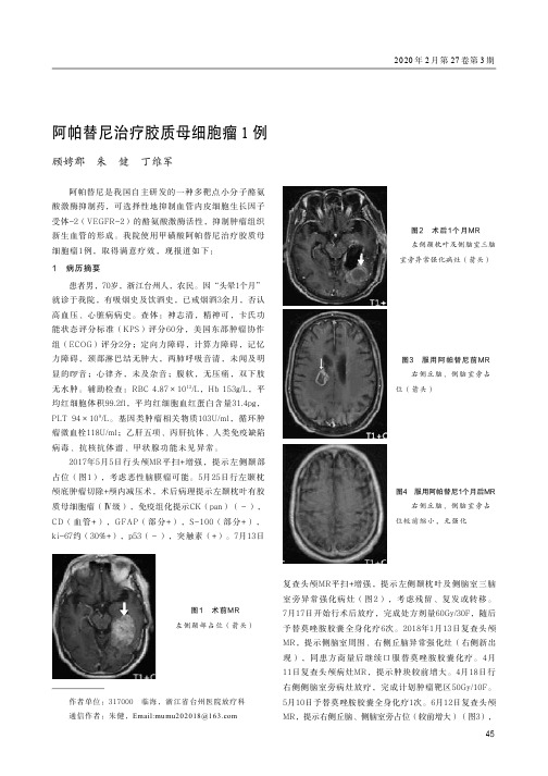 阿帕替尼治疗胶质母细胞瘤1例