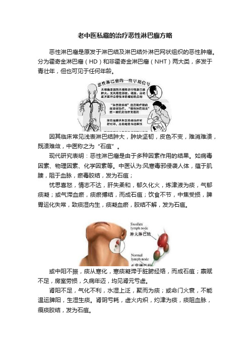 老中医私藏的治疗恶性淋巴瘤方略