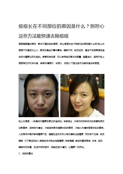 痘痘长在不同部位的原因是什么？别担心这些方法能快速去除痘痘