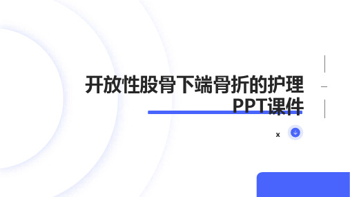 开放性股骨下端骨折的护理PPT课件