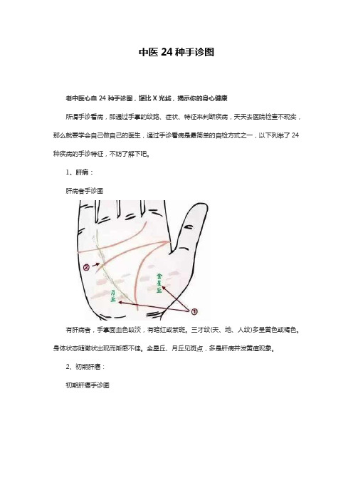 中医24种手诊图