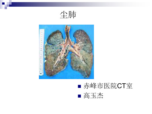 尘肺影像表现