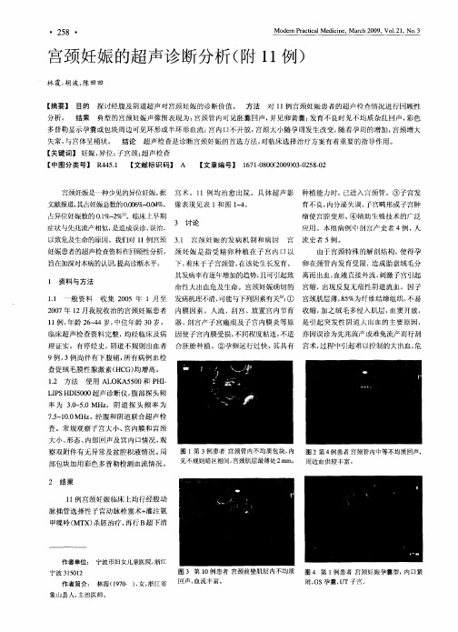 宫颈妊娠的超声诊断分析(附11例)