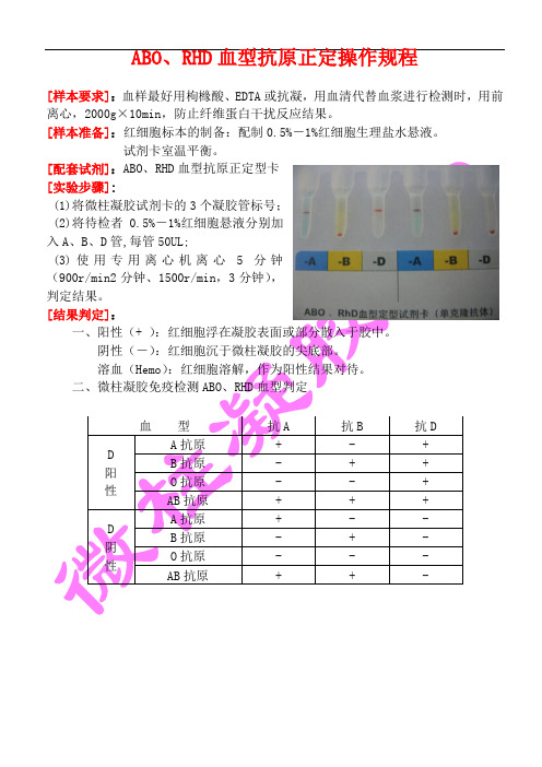正定型操作规程