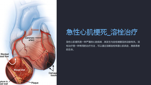 急性心肌梗死_溶栓治疗