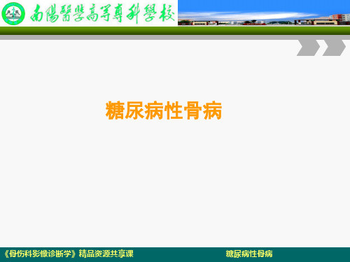 糖尿病性骨病.ppt