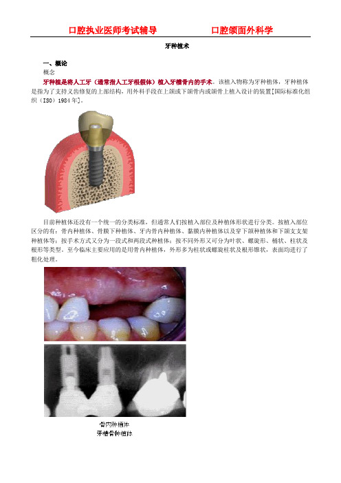 口腔颌面外科学-医考讲义-牙种植术