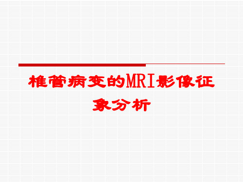 椎管病变的MRI影像征象分析培训课件