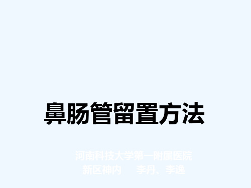 鼻肠管留置方法