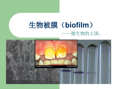 biofilm