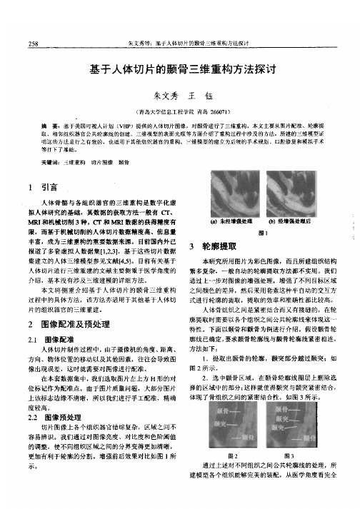 基于人体切片的颞骨三维重构方法探讨