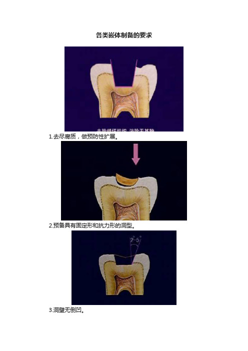 各类嵌体制备的要求