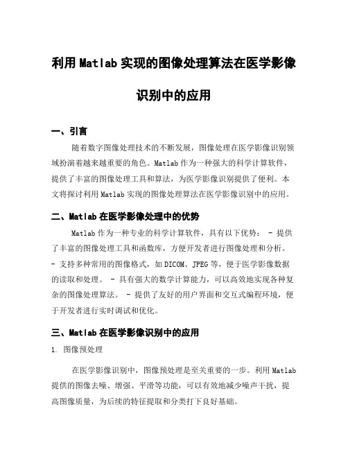 利用Matlab实现的图像处理算法在医学影像识别中的应用