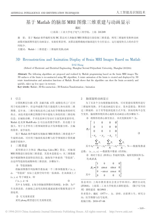 基于Matlab的脑部MRI图像三维重建与动画显示