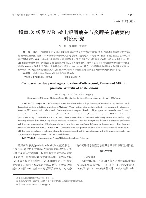 超声、X线及MRI检出银屑病关节炎踝关节病变的对比研究