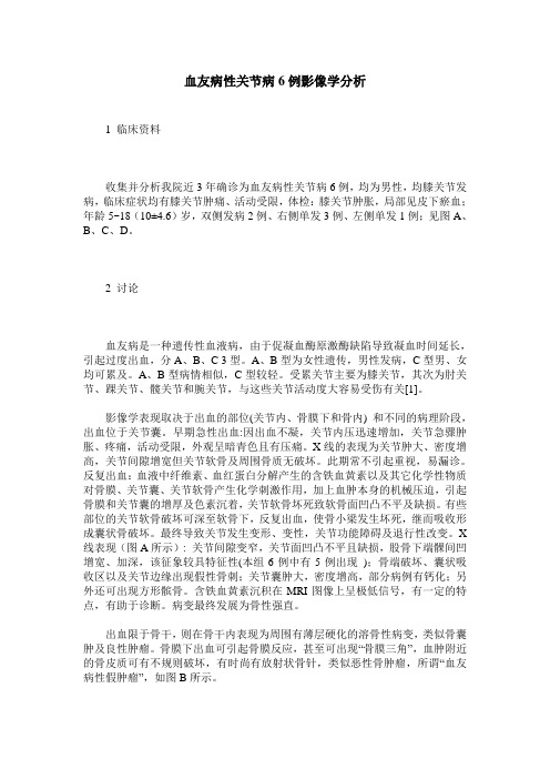 血友病性关节病6例影像学分析