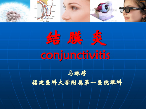 结膜炎 眼科(1)