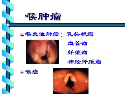 喉部临床常见肿瘤ppt课件