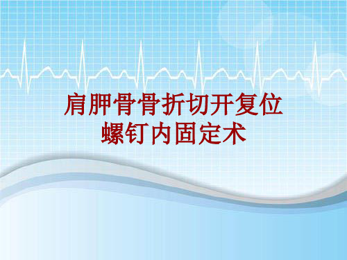 外科手术教学资料：肩胛骨骨折切开复位螺钉内固定术讲解模板