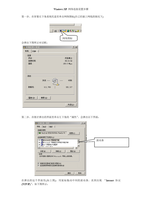 Windows XP 网络连接设置步骤