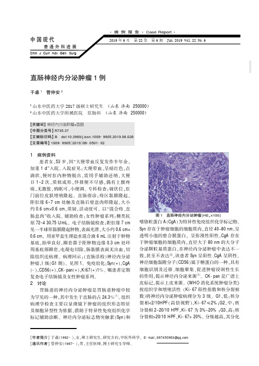 直肠神经内分泌肿瘤1例