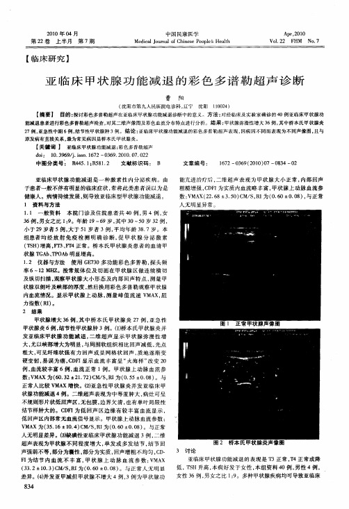 亚临床甲状腺功能减退的彩色多谱勒超声诊断