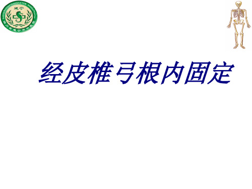 经皮椎弓根内固定PPT医学课件