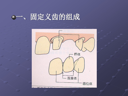 固定义齿的组成由固位体