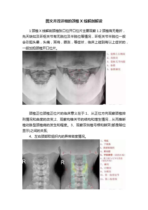 图文并茂详细的颈椎X线解剖解读